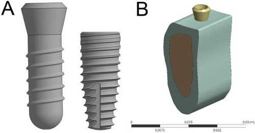 Figure 1. (A) Implant models: Soft tissue level left and bone level right. (B) Soft tissue level implant positioned on the reconstructed mandible section.