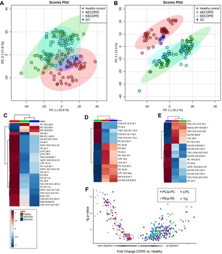 Figure 2 Dysregulated metabolites revealed by lipidomics. (A and B) Principle component analysis score plots of all sample groups in positive (A) and negative ion mode (B). Groups are presented in different colors (AECOPD, green; SSCOPD (Stable COPD), blue; healthy control, red; QC, dark blue). (C) Heat map presenting lipids dysregulated in three groups. (D) Heat map presenting lipids that are only dysregulated in AECOPD. (E) Heat map presenting lipids that are only dysregulated in SSCOPD (Stable COPD). (F) Heat map presenting lipids that are only dysregulated in the Healthy control.