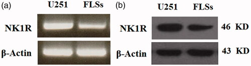 Figure 1. Neurokinin 1 receptor (NK-1R) is expressed in human fibroblast-like synoviocytes (FLSs). We applied the human glioblastoma cell line U251 as a positive control. (a). RT-PCR results indicate that NK-1R is expressed in human FLSs at the gene level; (b). Western blot results indicate that NK-1R is expressed in human FLSs at the protein level.