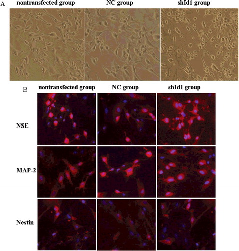 Figure 6. Neuronal differentiation of MSCs in vitro (×10): morphological phenotype of neuron-like cells under light microscope (A); neuronal marker expression in three groups (B): high expression in NSE and MAP-2, but low in Nestin.