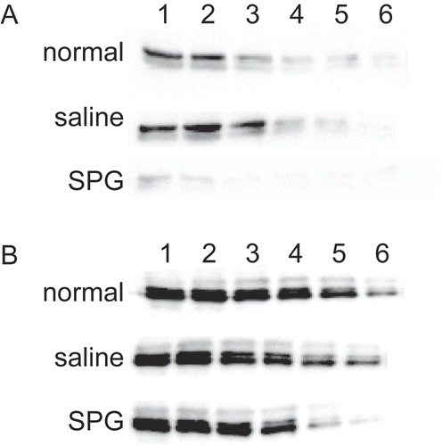 Figure 5.  CYP3A11 protein expression in liver microsomes from SPG-administered mice. Five-week-old ICR mice (A) and eight-week-old C3H/HeJ mice (B) were administered SPG (100 μg/mouse) or saline IP on Days -5, -3, and -1. On Day 0, liver microsomes were obtained and CYP3A11 protein expression was measured by Western blotting. Lane 1, 500 μg/ml; Lane 2, 250 μg/ml; Lane 3, 125 μg/ml; Lane 4, 62.5 μg/ml; Lane 5, 31.25 μg/ml; Lane 6, 15.625 μg/ml.