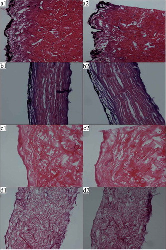 Figure 2. Tissue images of NFS and PFS dyed by heamatoxylin-eosin method at a magnification of 100 (a1, a2 and c1, c2: transverse cutting figure of NFS and PFS, respectively; b1, b2 and d1, d2: longitudinal cutting figure of NFS and PFS, respectively).