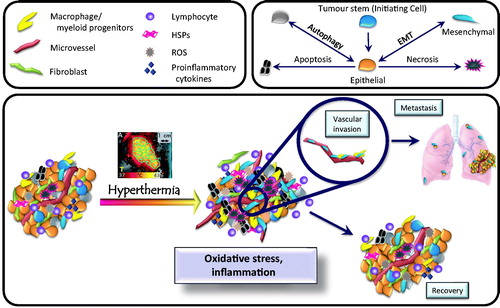 Figure 1. Overview of the tumour microenvironment. The upper boxes contain symbols for cell types found in tumours, along with factors that influence the tumour microenvironment. Many cell types are found, including macrophages, lymphocytes, fibroblasts, and vascular endothelial cells. Cross talk between these cell types promotes tumour growth. The lower box summarises how the microenvironment changes in response to hyperthermia. Under baseline conditions (left), tumours contain a variety of different cell types. Pleiotropic tumour cell phenotypes include stem cells, cells exhibiting epithelial or mesenchymal characteristics, and cells undergoing autophagy. Oxidative stress and inflammation then influence which phenotype predominates following hyperthermia treatment. Changes induced by hyperthermia include (1) altering cytokine and chemokine levels, (2) promoting tumour cell survival, (3) driving epithelial cells toward mesenchymal (invasive) phenotype, (4) promoting metastasis, and (5) altering immunogenicity of the remaining tumour cells.