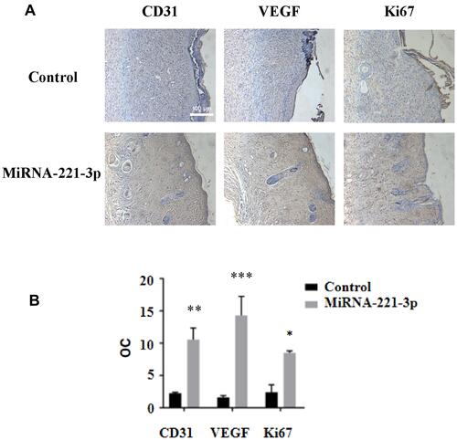 Figure 7 Immunohistochemical staining of miRNA-221-3p–treated skin wound tissue in normal mice. Representative immunohistochemical images (A) and summary data (B) showing immunostaining of the skin wound tissue from normal mice treated with miRNA-221-3p (expressed as integrated optical density/total area; OC) (magnification, 200×). All values are presented as means and standard deviations (n = 3). Statistically significant differences are indicated by *P < 0.05,**P < 0.01, ***P < 0.001, compared with the control group treated with PBS.