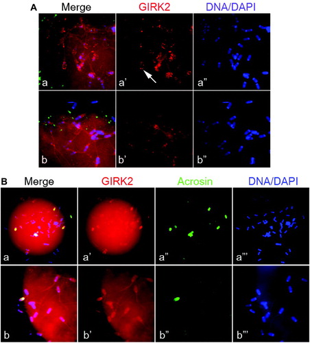 Figure 8.  A) Immunocytochemical analysis of spermatozoa bound to the zona pellucida (ZP) of porcine oocytes in the presence or absence of anti-GIRK2 antibody (red). a-a”) Porcine oocytes were fertilized with rabbit polyclonal anti-GIRK2 antibody, and b-b” porcine oocytes were fertilized with non-immune rabbit serum as control. The white arrow indicates GIRK2 localization in the sperm acrosome (red fluorescence; a’). Spermatozoa DNA (blue) was counterstained with DAPI. B) Acrosomal status of zona-bound spermatozoa during IVF was determined by anti-acrosin antibody staining (green fluorescence). a-a”‘) Porcine oocytes were fertilized with rabbit polyclonal anti-GIRK2 antibody (red). b-b”‘) Porcine oocytes were fertilized with non-immune rabbit serum as control. Spermatozoal DNA (blue) was counterstained with DAPI. Dim oocyte autofluorescenc is visible in the background of panel b’’.
