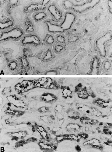 Figure 1. Immunolocalization of albumin in the renal cortex of a rat killed on day 18 after treatment with 3.5 mg/kg adriamycin (B) and of a control rat (A). Note that the immunostaining in the cytoplasm of the tubular cells is more intense in B. ×420.