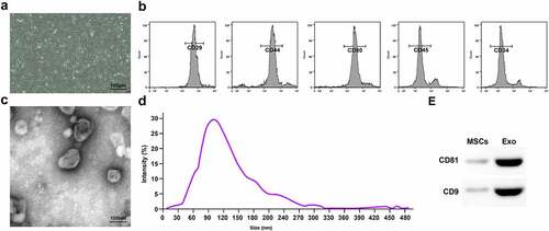 Figure 1. Identification of BMSCs and BMSCs-Exo. A. Morphology of BMSCs of P3; B. Analysis of surface markers by flow cytometry; C. TEM observed size and morphology of BMSCs-Exo; D. NTA of BMSCs-Exo; E. Western blot analysis of CD81 and CD9.