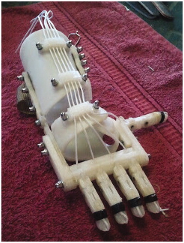 Figure 1. Robohand: the hand that was the inspiration for the development of the global community. Image reproduced with permission from Brod Marsh on behalf of Robohand Australia see http://www.robohand.net/wp-content/uploads/2013/03/2013-03-29-11-10-58-b.jpg, i.e., the copyright holder.