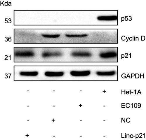 Figure 8 LincRNA-p21 affected on the expression of p53 and its downstream genes. Western blotting revealed a significant subsiding in Cyclin D protein expression and increasing in p21 protein expression in EC09 cells transfected with LincRNA-p21-targeting lentivirus.