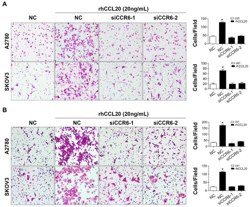 Figure 3 Knockdown of CCR6 inhibits CCL20-mediated migration and invasion of ovarian cancer cells.