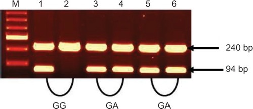 Figure 2 The amplification of TNF-β (+252A/G) genotypes (GG and GA).Notes: Lane M: 100 bp DNA marker. Lanes 1, 3, and 5: amplification of allele G. Lanes 2,4, and 6: amplification of allele A. A 94 bp band for target DNA and 240 bp band for internal control were used.Abbreviation: TNF-β, tumor necrosis factor-beta.