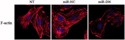 Figure 9. Effects of miR-206 on cytoskeletal stabilization in podocyte. miR-206 promoted the rearrangement of stress fibers in podocyte, causing podocyte cytoskeletal injury compared with the NT and miR-NC group.