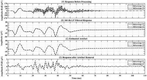 Figure 1. Contralateral responses (two sub-averages) from CI08 (MED-EL Concerto Flex 28 – FS4) showing (A) Response before processing (prior to filtering and artefact removal) that is very large in amplitude-BAR containing an excessive high-frequency artefact, (B) LP filtered response (300 Hz) that is smaller in amplitude than (A) with no high-frequency artefact, (C) artefact that was estimated from the LP filtered response and (D) final response after artefact removal that is much smaller in amplitude-PAR than (A) and (B) and contains speech-ABR characteristics combined with residual artefact. *Note that in order for the response to be visible in all subplots, the y-axis scale is not equal across sub-plots.