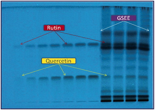 Figure 1. Pictogram of developed RP-HPTLC plate at λ = 254 nm; mobile phase, acetonitrile:water (4:6, v/v).