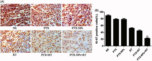 Figure 5. Ki-67 immunohistochemical staining in tumors. (A) Ki-67 immunohistochemical images of tumor tissue from mice in various groups. (B) Ki-67 quantitative analysis in xenografts from mice in various groups. *p < 0.05 and **p < 0.01. Original magnification, ×400.