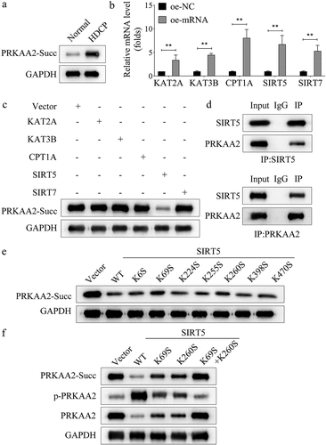 Figure 3. SIRT5 interacts with PRKAA2 to inhibit PRKAA2 succinylation a. the level of PRKAA2 succinylation in the placental tissue of HDCP patients or normal puerpera was measured through western blot. b. Succinylation regulators, including P300 (KAT3B), KAT2A, CPT1A, SIRT5 and SIRT7 were overexpressed in primary placental cells, and the overexpression efficiency was identified using qPCR. c. the effects of overexpression of succinylation-related mRnas on the level of PRKAA2 succinylation were analyzed by western blot analysis. d. the interaction between SIRT5 and PRKAA2 was then proven by Co-IP assay. e. the sites of PRKAA2 succinylation induced by SIRT5 were identified through western blot analysis. f. the effects of SIRT5 overexpression on the succinylation, phosphorylation, and protein levels of PRKAA2 were detected using western blot analysis in each group. **P < .01 indicated statistically significant difference between groups.