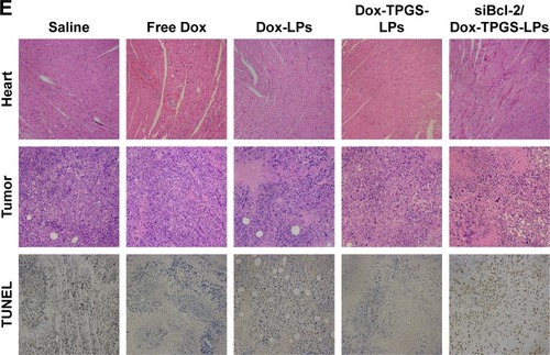 Figure 8 In vivo antitumor efficacy of the different formulations in H22 tumor-bearing BALB/c female mice.Notes: (A) Tumor volume and (B) body weight changes during the treatment period. The black arrows on the x-axis represent the time points of intravenous injections (ie, Days 1, 3, 5, 8, and 11). The injected dose of Dox and siBcl-2 per administration was 5 mg/kg and 1.2 mg/kg, respectively (n=5). (C) The weight and (D) image of tumors separated from the mice at the end of the experiment. (E) H&E staining of the heart and tumor tissues, and immunofluorescence analysis of the tumor tissues. The red dotted circles represent damaged cardiomyocytes after free Dox treatment. Data are presented as mean ± SD (n=5). *P<0.05 and **P<0.01.Abbreviations: Dox, doxorubicin; LPs, liposomes; siBcl-2, Bcl-2 siRNA; TPGS, D-α-tocopherol polyethylene glycol 1000 succinate.