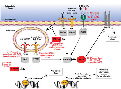 Figure 2 Genetic variants disrupt TLR/IL-1R family signaling in IPF.