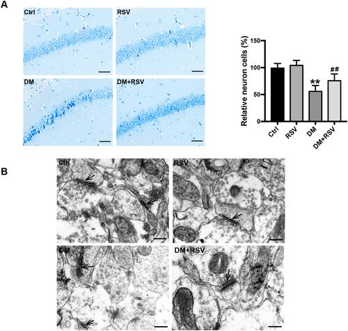 Figure 3 RSV prevents T2DM-induced hippocampal neuronal destruction and synaptic ultrastructural damage. (A) Representative images of Nissl-stained neurons in the mouse hippocampal CA1 region (400×, scale bar=50 μm). The number of neurons was quantitatively analyzed. (B) Ultrastructural changes in synapses (indicated by black arrows) in the CA1 region of the hippocampus as observed by TEM (Scale bar=250 nm). The data are expressed as the mean ± SD (n = 3). **P < 0.01 vs Ctrl; ##P < 0.01vs. DM.Abbreviation: TEM, transmission electron microscopy.