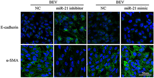Figure 5 MiR-21 regulates the expression of BEV-induced EMT markers in ARPE-19 cells.MiR-21 inhibitor increased E-cadherin and decreased α-SMA expression. However, miR-21 mimic suppressed E-cadherin and enhanced α-SMA level.
