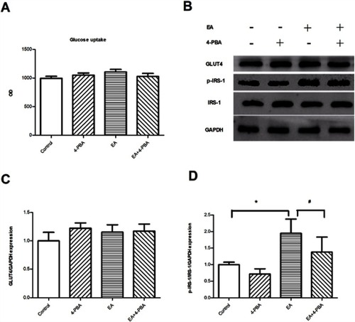 Figure 6 ER stress involves impaired insulin receptor signaling in human adipocytes. (A) Glucose uptake capacity; (n=6); (B) representative Western blots of GLUT4 and IRS-1 in human mature adipocytes; (C) quantification of the Western blot for GLUT4; (D) quantification of the Western blot for IRS-1. (n=3); *P<0.05 compared to control group. #P<0.05 compared to EA group.