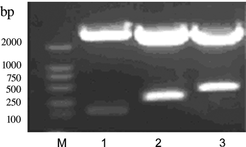 Figure 1.  Identification of pRSET-1CCK, pRSET-2CCK and pRSET-4CCK. M, DL2000 marker; 1, Bam HI/Sac I-digested pRSET-1CCK, 1CCK was about 120 bp in size; 2, Bam HI/Sac I-digested pRSET-2CCK, 2CCK was about 230 bp in size; 3, Bam HI/Sac I-digested pRSET-4CCK, 4CCK was about 450 bp in size.