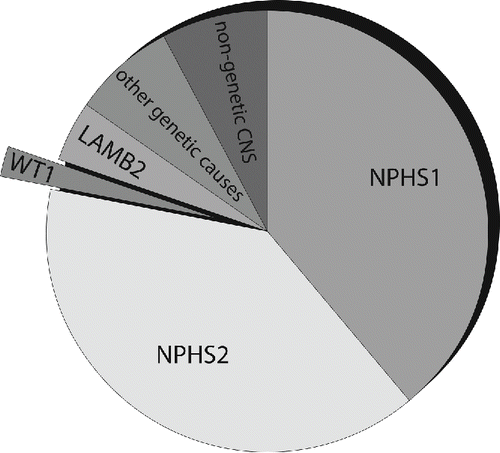 Figure 1. The majority of CNS in the first three month of life is caused by the following genes: The NPHS1 gene codes for nephrin and is responsible for the Finnish type CNS; the NPHS2 gene codes for podocin and leads to familial focal segmental sclerosis. Less common is a WT1 gene mutation causing DDS or Frasier syndrome. The LAMB2 gene is also associated with CNS and leads to Pierson syndrome. Other infrequent mutations in PLCE1, LMX1B (responsible for Nail–Patella syndrome) and LAMB3 have also been described. A small part is attributed to a nongenetic etiology with CNS due to congenital syphilis, congenital toxoplasmosis, congenital CMV infection or neonatal autoantibodies against endopeptidase.