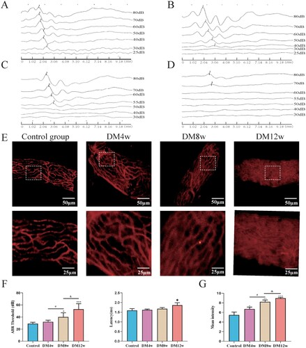 Figure 1. Diabetes results in permanent hearing loss and leakage of cochlear stria vascularis in C57BL/6J mice. A-D: Representative images of ABR waveforms in each group of mice (Control, DM4w, DM8w, DM12w); E: Representative images of Evans blue staining in each group of mice (Scale bar = 50 μm) and zoomed-in images (Scale bar = 25 μm); F: Statistical figure of ABR wave I hearing threshold of mice in each group and Latency statistics of ABR I wave, n = 10 mice per group, One-way Anova with Turkey’s post-hoc test, *P < 0.05, **P < 0.01,***P < 0.001 vs Control, #P < 0.05 vs DM4w group, &P < 0.05 vs DM8w group; G: Leakage fluorescence density statistical diagram of each group, n = 5 mice per group, One-way Anova with Turkey’s post-hoc test, *P < 0.05, **P < 0.01,***P < 0.001 vs Control, #P < 0.05 vs DM4w group, &P < 0.05 vs DM8w group. Data are presented as the means ± SEMs.