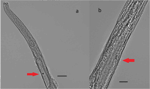 Figure 5. Chromadorita regabi sp. nov. Light micrographs of the female. (a) Anterior region showing pharynx with posterior bulbus and ventral gland (red arrow). (b) Detail of the ventral gland (red arrow) behind the pharynx, on the ventral side of the gut. Scale bars: A = 20 µm; B = 50 µm.