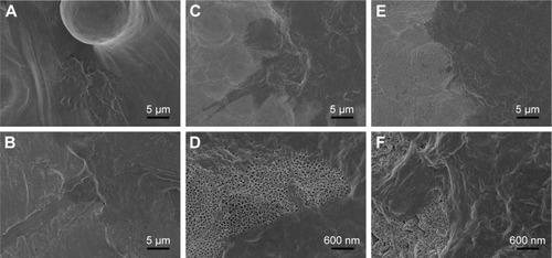 Figure 8 Representative SEM images of HGECs’ adhesion to the surfaces of each group after 24 hours (scale bar of A–C, E =5 µm, scale bar of D, F =600 nm).Notes: (A) SLM; (B) MP; (C, D) AO; (E, F) AOC.Abbreviations: SEM, scanning electron microscopy; HGECs, human gingival epithelial cells; SLM, selective laser melting; MP, mechanically polished; AO, anodic oxidation; AOC, anodic oxidation composited with electrochemical deposition.