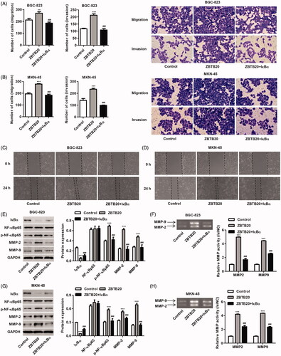 Figure 8. IκBα overexpression inhibits gastric cancer cell migration and invasion induced by ZBTB20. BGC-823 and MKN-45 cells were infected with pCDNA3.1(+)-ZBTB20 and pCDNA3.1(+)-IκBα. Cell migration and invasion were determined by Transwell (A, B) and Wound healing assay (C, D); the protein expression of IκBα, p-NF-κBp65, NF-κBp65, MMP-2 and MMP-9 (E, G) was determined by western blotting; and the activity of MMP-2 and MMP-9 was determined by Gelatin zymography gel assay (F, H). **p < .01, ***p < .001 compared with control; ###p < .001 compared with pCDNA3.1(+)-ZBTB20.