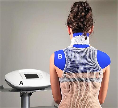 Figure 1 The image shows the example of a patient suffering from non-specific neck pain during the administration of the tissue optimization treatment. (A) device based on REAC technology, model BENE 101 (ASMED, Florence, Italy); (B) asymmetric conveyer probe (ACP). The ACP is connected to device (A) via a specific connection cable. The ACP is held in place using an elastic tubular mesh.