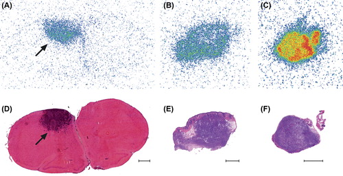 Figure 3. Autoradiography demonstrates high tumor uptake of [68Ga]DOTATOC and [18F]FDR-NOC. Representative autoradiographs showing (A) uptake of [68Ga]DOTATOC in rat orthotopic BT4C glioma, (C) uptake of [68Ga]DOTATOC in subcutaneous BT4C tumor, and (E) uptake of [18F]FDR-NOC in another subcutaneous BT4C tumor. (B, D, F) Lower panel shows H&E stainings of the corresponding sections. Arrow indicates the tumor in rat brain. Bar = 1 mm.