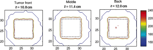 Figure 10. Thermal dose accumulated in the 4.4-cm3 tumour volume. Shown are the front (z = 10.8 cm), middle (z = 11.4 cm) and back (z = 12 cm) planes of the tumour. The tumour boundary is shown as a dashed line.