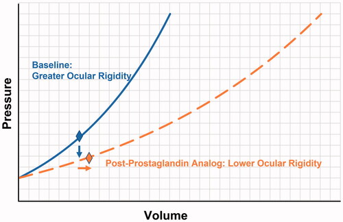 Figure 8. Visual representation demonstrating how a reduction in IOP (vertical arrow) from baseline value (diamond on solid line) to new value (diamond on dashed line) after Prostaglandin Analog (PGA) treatment can be accompanied by an increase in anterior chamber volume (horizontal arrow) if the ocular rigidity drops from a greater value at baseline (solid curve) to a lower value (dashed curve) caused by the reduction in scleral stiffness with PGA treatment.Citation33