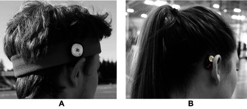 Figure 1 Combined head-impact and postural sway monitoring inertial motion unit sensors (A) worn with an athletic headband; and (B) attached to the skin using an adhesive patch.