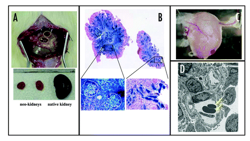 Figure 3 Generation of vascularized neo-kidney from hMSCs. LacZ-positive hMSCs were differentiated in vivo using the modified relay culture system (A). Yellow dotted lines indicate the outline of the developed kidney in the omentum (top). These were dissected out and compared with native kidney (bottom). The resulting neo-kidney was subjected to X-gal assay to trace the transplanted hMSCs (B, top). The morphology of these LacZ-positive cells (shown under high magnification, bottom) and the renal structures to which they contributed was consistent with their being glomerular cells (left) and tubular cells (right). High magnification imaging revealed that several vessels from the omentum were integrated into the no-kidney (C) and electron microscopic analysis showed that the glomerular vasculature contained red blood cells (arrows), which might have derived from the host circulation (D). Reproduced with permission.Citation77