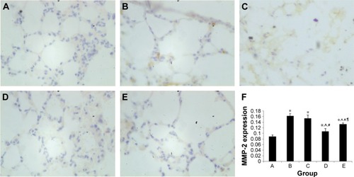 Figure 7 MMP-2 protein expression in immunohistochemical staining.Notes: (A) Control group. (B) PBS early intervention group. (C) PBS late intervention group. (D) EPC early intervention group. (E) EPC late intervention group. (F) MMP-2 protein expression in each group; labels A–E relate to the parts A–E. Brown cells in A, B, C, D and E indicated MMP-2 positive cells. *, ^, #, ¶ represent significant difference (P<0.05) with the control group, PBS early intervention group, PBS late intervention group, and EPC early intervention group, respectively.Abbreviations: EPCs, endothelial progenitor cells; MMP, matrix metalloproteinase; PBS, phosphate-buffered saline.