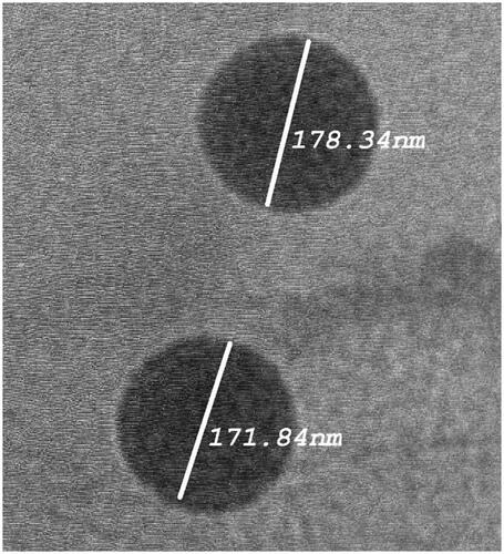 Figure 2. Transmission electron micrographs of optimized LTD-TRS formulation.