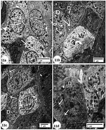 Figure 11. Electron micrograph of collecting tubules (a): control group showing two cell types are seen in the collecting ducts of the cortex are lined by principal (light) (L) cells and intercalated (dark) (D) cells. The dark cells are characterized by having more electron-dense cytoplasm (arrow head). The light cells have more electron-lucent cytoplasm (arrow). Relatively long tight junctions (J) (Scale bar of a = 2 µm). (b): CCl4 group showing the principal (light) (L) cell has pale cytoplasm with electron-dense mitochondria (arrow), and frequent infolding’s of the basal cell membrane (curve arrow). The intercalated (dark) (D) cells appeared a few mitochondria (arrow) and some vacuoles (V) (Scale bar of b = 2 µm). (C): CCl4 + rats BM-MSCs showing marked recovery of the principal (light) (L) cells and intercalated (dark) (D) cells have numerous mitochondria (arrow) (Scale bar of c = 2 µm). (d): CCl4 + mice BM-MSCs showing almost normal of the principal (light) (L) cells with numerous mitochondria (arrow) and intercalated (dark) (D) cells have elongated mitochondria (arrow) (Scale bar of c = 2 µm).