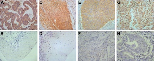 Figure 1 Immunohistochemical staining of HPIP in cervical tissues (×400).