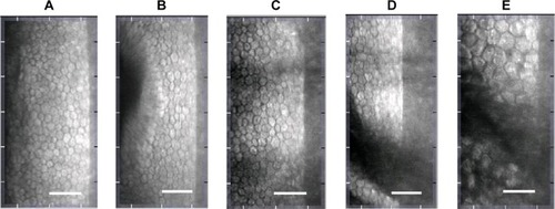 Figure 2 Changes of endothelial cell density at the center of the eye.