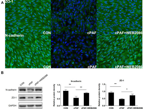 Figure 3 Effect of carbamyl-platelet-activating factor (cPAF) on the distribution and expression of junction proteins in an ARPE-19 monolayer. Cells were incubated with 100 nM cPAF for 6 days and then fixed and immunolabeled with antibodies specific for ZO-1 and N-cadherin. Immunostaining of an untreated ARPE-19 monolayer for ZO-1 and N-cadherin revealed continuous labeling in the regions of cell–cell contact. Incubation with cPAF caused marked disruption of ZO-1 and N-cadherin staining. This effect of cPAF was inhibited by WEB 2086 (A). Cells were incubated with 100 nM cPAF for 6 days, lysed, and subjected to Western blotting with antibodies specific for ZO-1 and N-cadherin. GAPDH was used as a loading control. We detected significant decreases in the levels of both ZO-1 and N-cadherin in response to cPAF, and this effect was inhibited by treatment with WEB 2086 (B). The quantitative protein expression data are shown as means ± standard errors of the means. *p < 0.05, **p < 0.01.