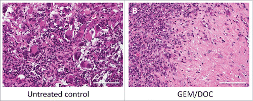 Figure 7. Histological response. A. The untreated control comprised viable cells without necrosis. B. The tumor treated with GEM and DOC exhibited necrosis. Scale bars: 100 μm.