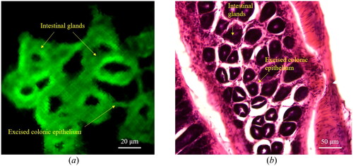 Figure 12. (a) An acquired image of sectioned mouse colon and (b) the relevant H&E stained colon image. The scale bar represents 20 µm.