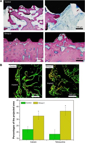 Figure 11 Histology and histomorphometric analysis of the polished and microroughened PEEK/n-HA/CF biocomposite implants.Notes: (A) Histotomy of bone contact immunostained by toluidine blue–fuchsine staining at 8 weeks with low and high magnification. The pink area represents the newly-formed bone, and dark black area represents the implants. (B) Fluorochrome labeling and quantitative determination with calcein and tetracycline show the greater new bone formation on the surface of the microroughened CFRPEEK-based biocomposite. *P<0.05 compared to the control.Abbreviations: PEEK/n-HA/CF, carbon fiber-reinforced polyetheretherketone–nanohydroxyapatite; CFRPEEK, carbon fiber-reinforced polyetheretherketone.