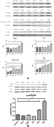 Figure 4 Production of IL1β occurs through activating NLRP3 inflammasome in an NF-κB-dependent manner. (A) Compared with the control, IL1β, NLRP3, caspase-1p20 and ASC all showed increased expression with time, esp in the 48hrs. (B) p-p65/p65 ratio increases with time. Control: CAFs were incubated with DMEM and without exposed to the light; Light: CAFs were incubated with DMEM for 5hrs at 37°C and exposed to the light; ALA: CAFs were incubated with ALA (0.5 mM) for 5h at 37°C, but not exposed to the light;12hrs/24hrs/48hrs: CAFs were incubated with ALA (0.5 mM) and exposed to the light. We collected the cell samples in 12hrs/24hrs/48hrs.Notes: *p<0.05; **p<0.01; ***p<0.001.