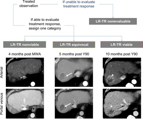 Figure 20 Treatment response categories with examples from a 70-year-old man who underwent transarterial radioembolization (Y90) followed by transarterial bland embolization and microwave ablation (MWA).