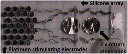 Figure 32. Suprachoroidal retinal implant showing the array of electrodes. Source: Ayton et al. 2015, PlosOne.