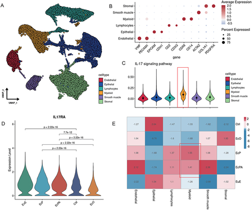 Figure 1 At the single-cell level, IL17RA is highly expressed in a subpopulation of myeloid cells in EM lesions. (A) More than 100,000 single cells from control and endometriotic tissues were shown by a Uniform manifold approximation and projection (UMAP) plot, identifying six major cell types. (B) Dot plots of marker gene expression of each major cell type identified in the scRNA-seq dataset. (C) Violin plots of IL-17 signaling pathway gene sets in different cell subpopulation scores. (D) Violin plots of IL17RA expression levels in different endometrial tissues. (E) The correlation heatmap of five uterine endometrial tissues with six major cell types.